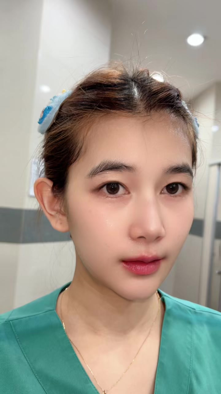 @แขนงน้อย