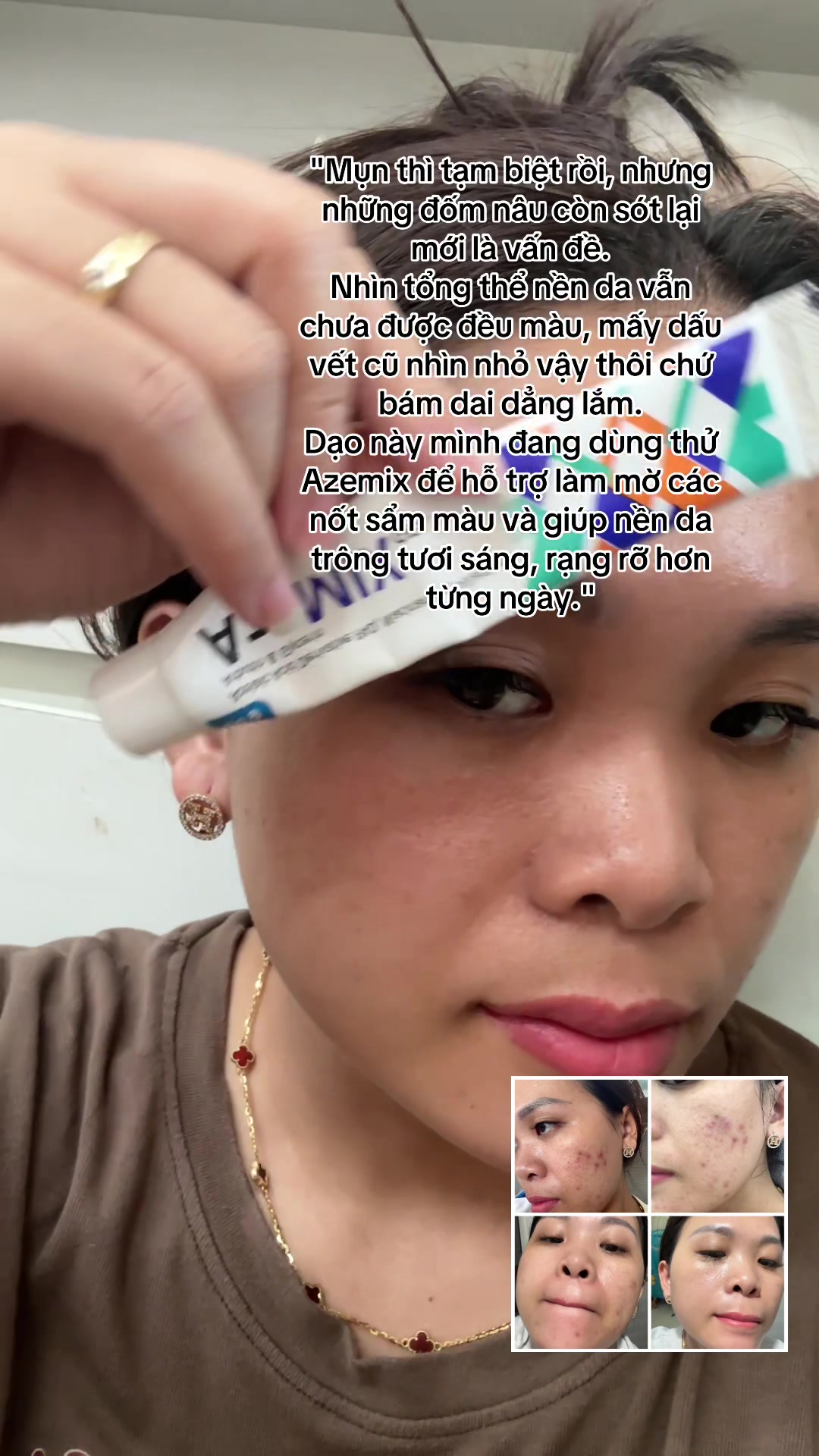 @Hoa Acne Skincare🌷