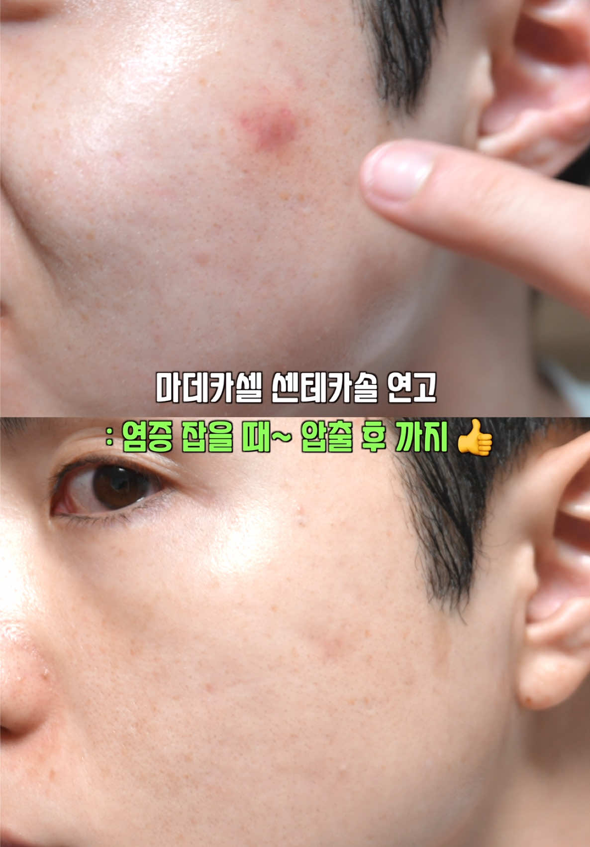 @털털이 TTE
