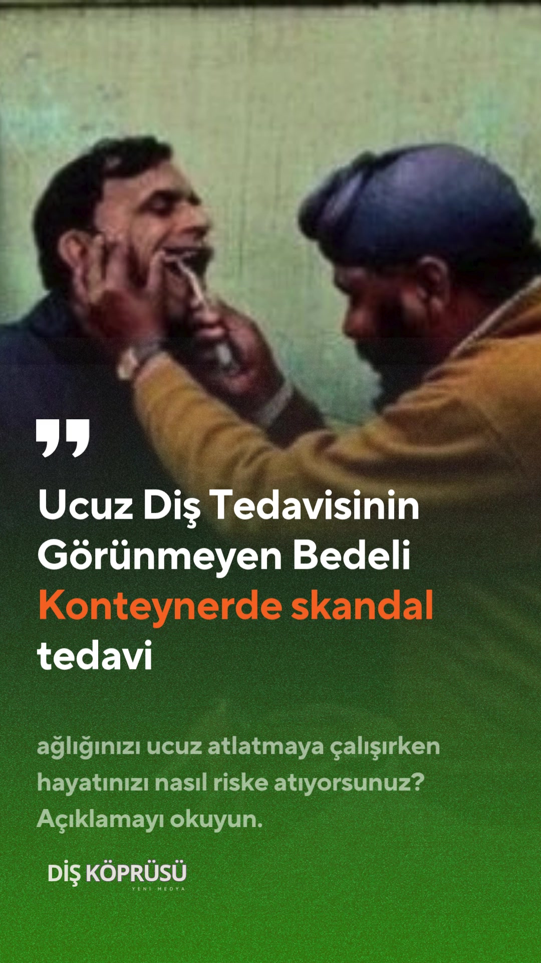 @Diş Köprüsü | Yeni Medya