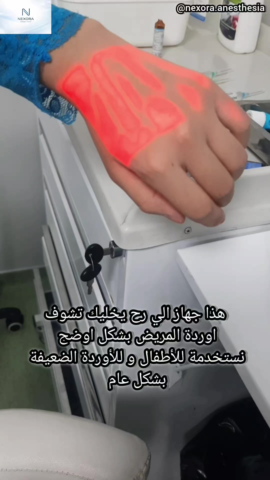 @Nexora Anesthesia