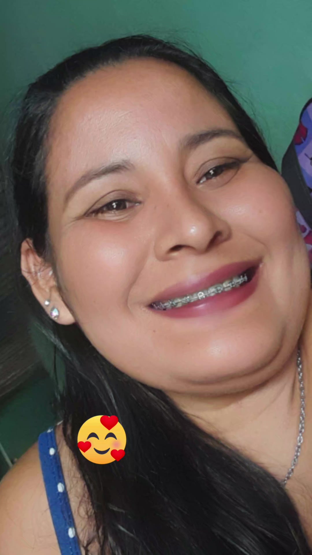 @Elizabeth Pereira