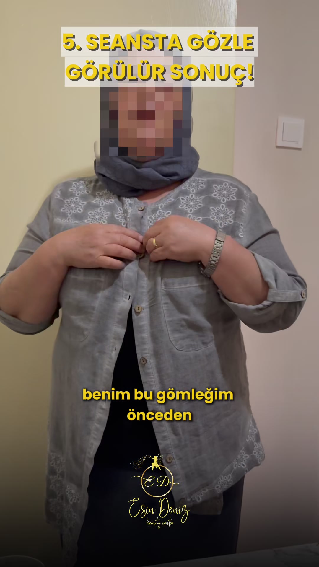 @Esin Deniz Beauty center