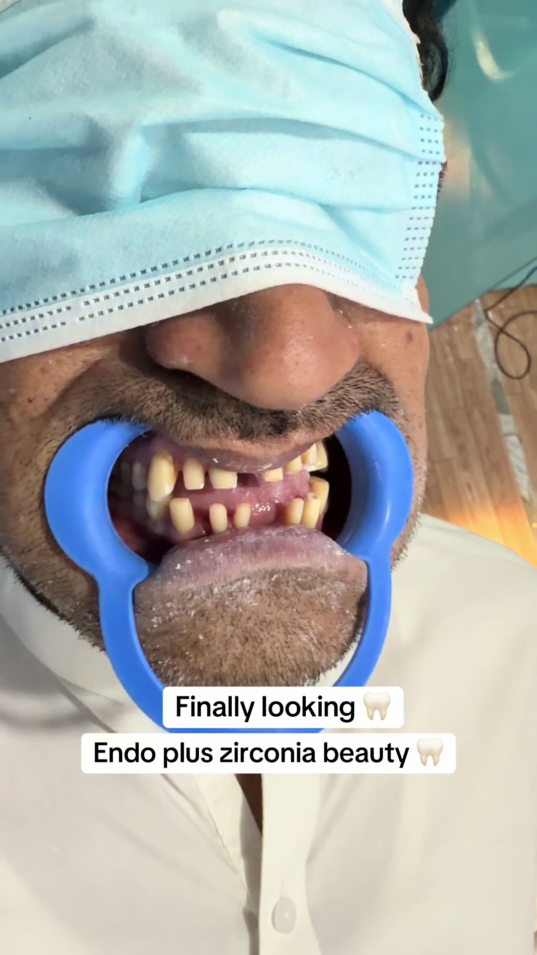 @DR Bilal Official🦷