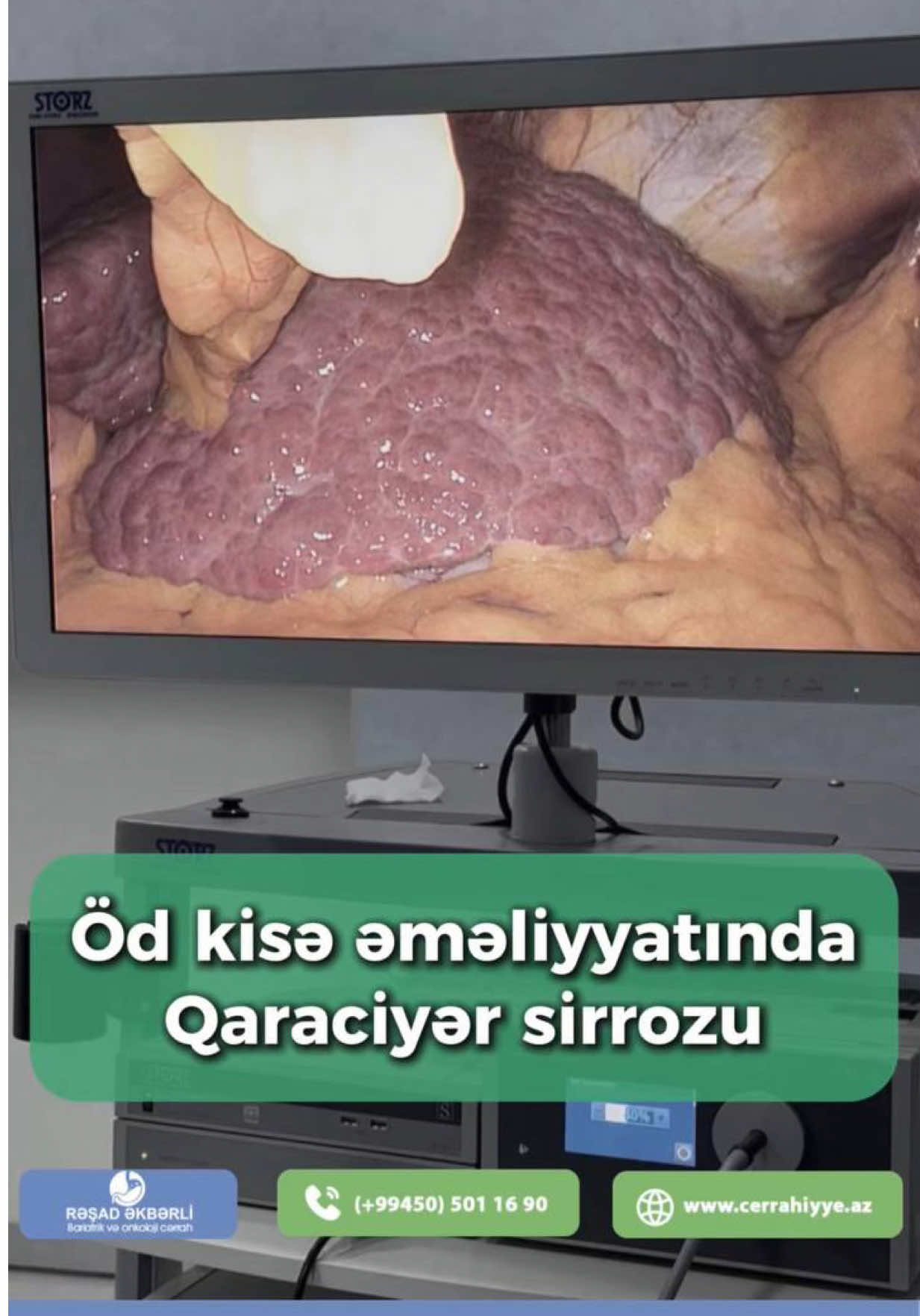 @Ümumi Cərrah Rəşad Əkbərli