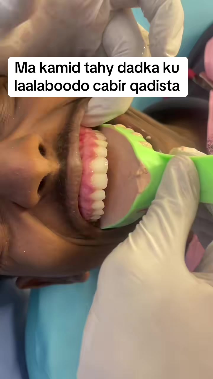 @Dr.Naasir🦷🩵🩺