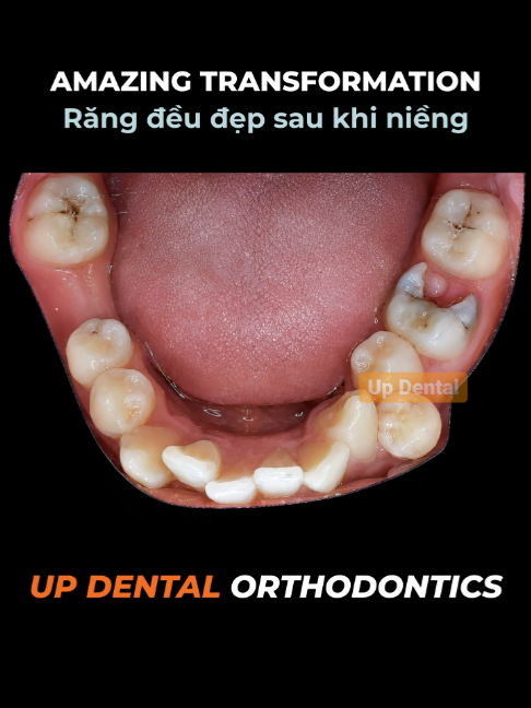 @Nha khoa niềng răng Up Dental