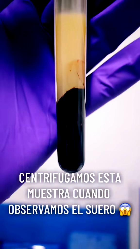 @ALab 🔬💉🩸
