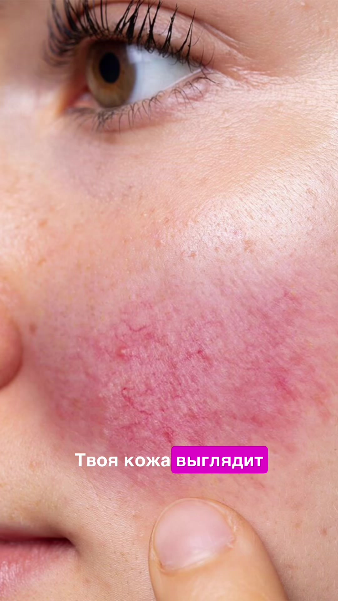 @ЭКОЛАЙФ