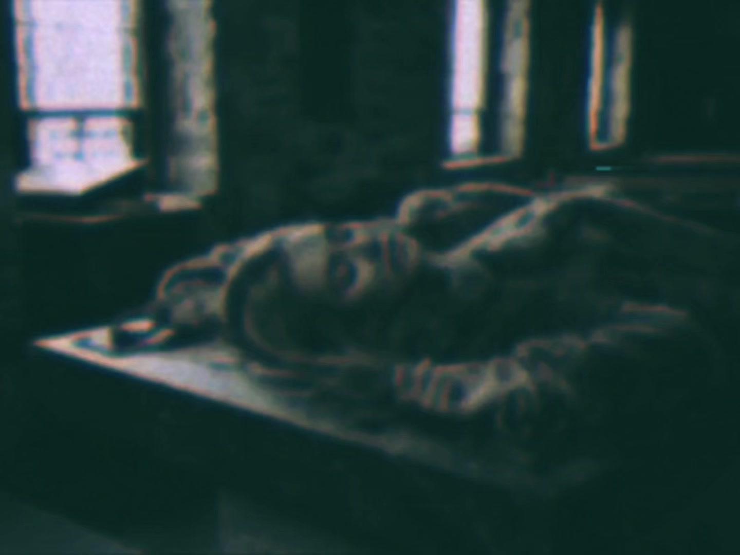 @ᴄᴏннᴀя ᴀᴩᴛᴇᴩия (соня сонная)