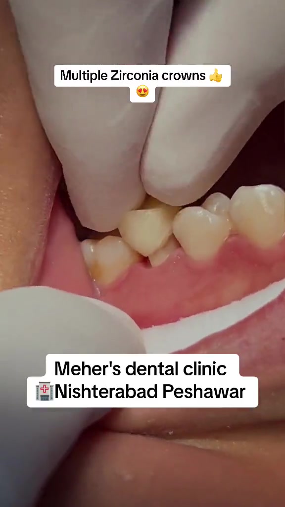 @dr_meher_official