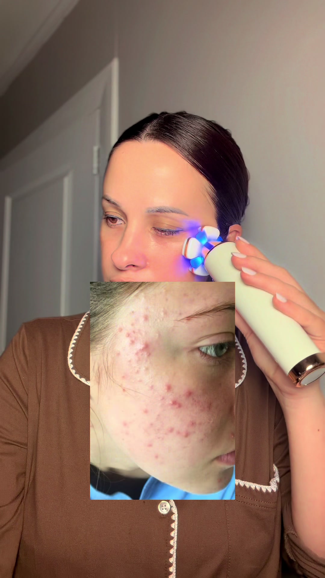 @JanadySerrano| Skincare