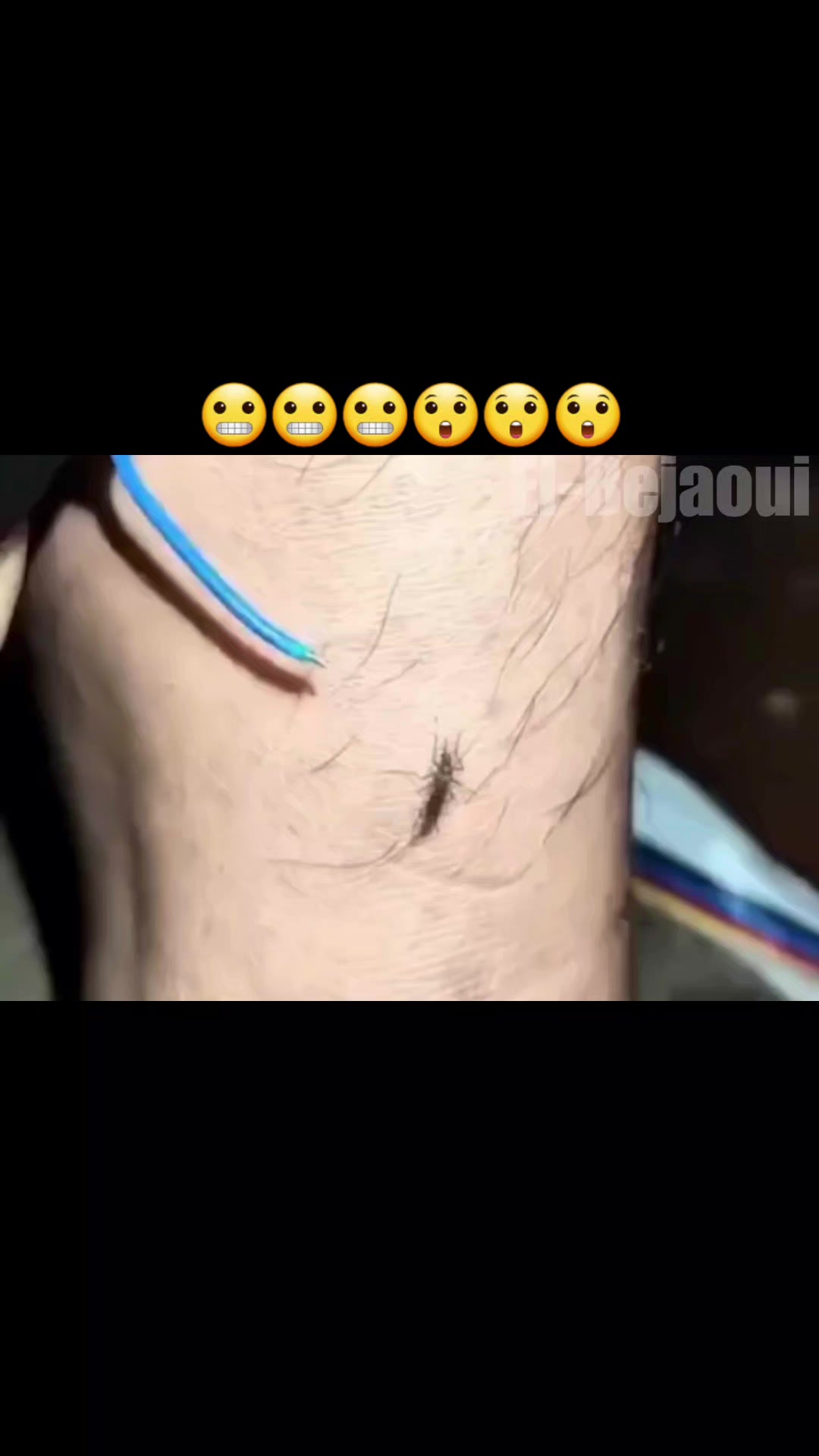 @Akram CA