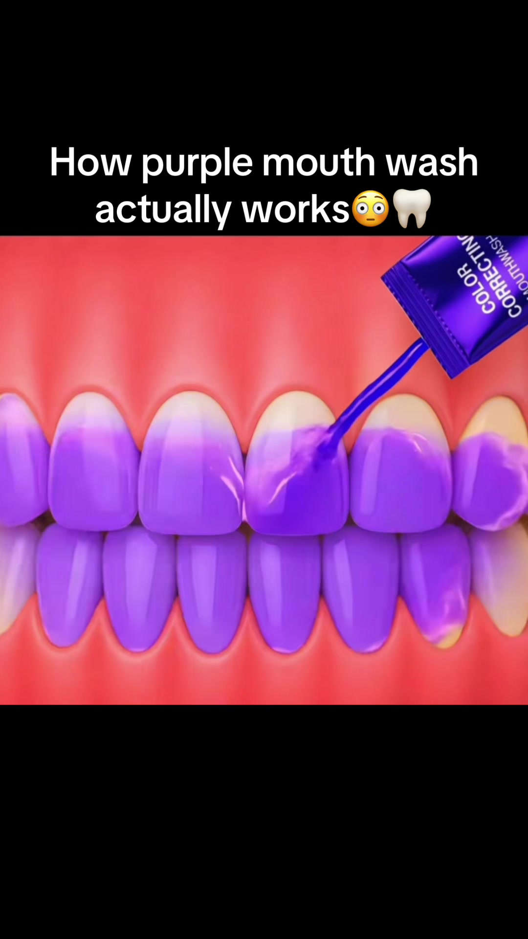 @…