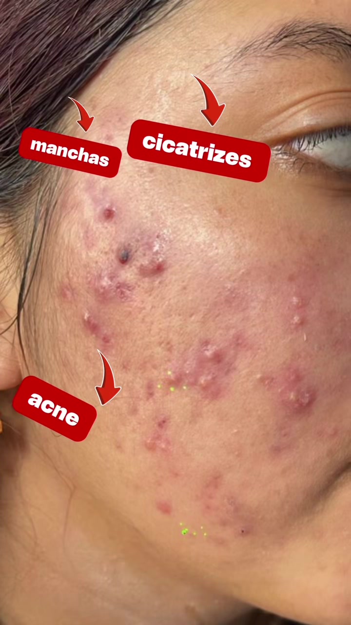@Dra Silvia Lorena FLORES derma