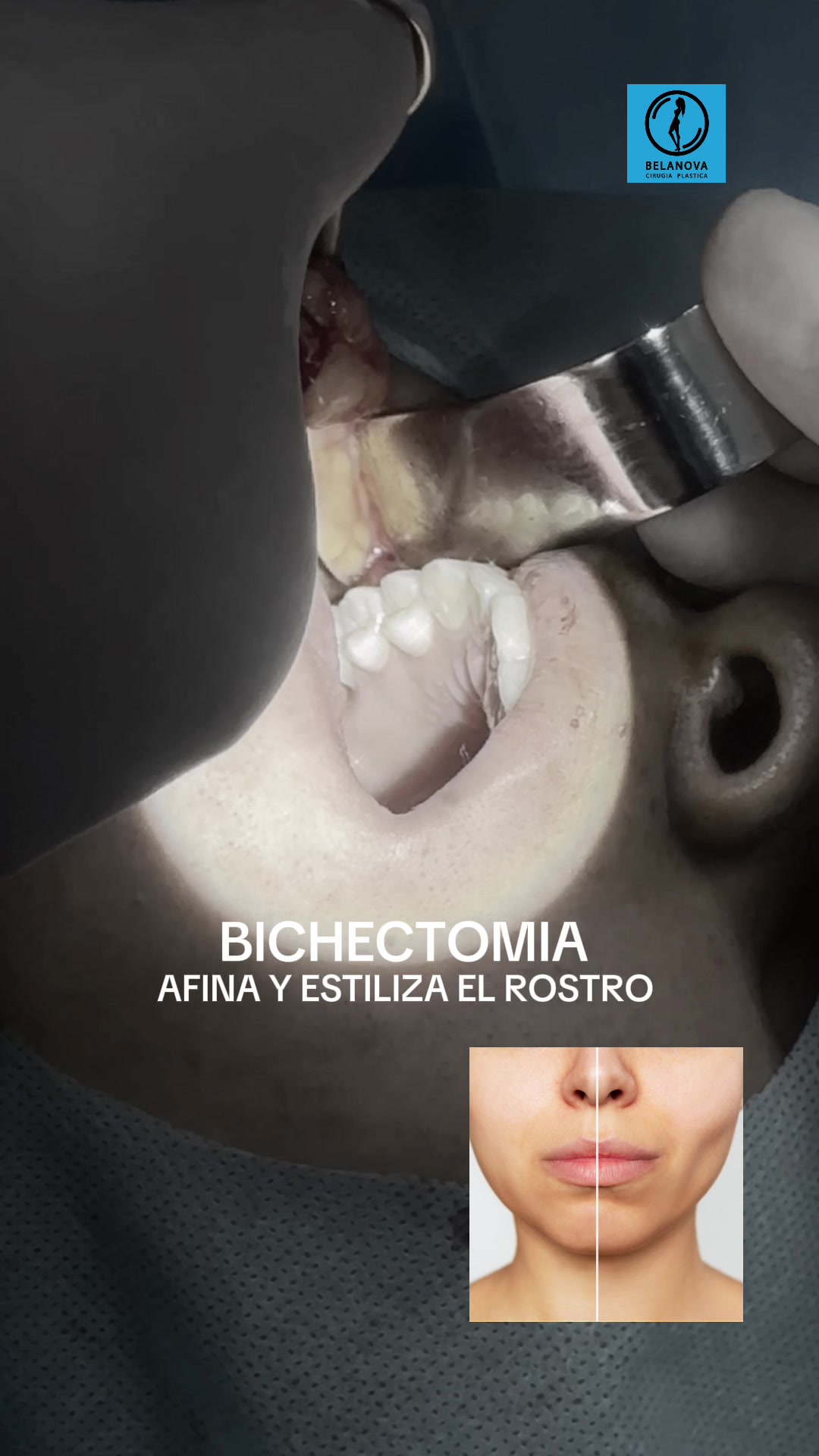 @Belanovacirugiaplastica