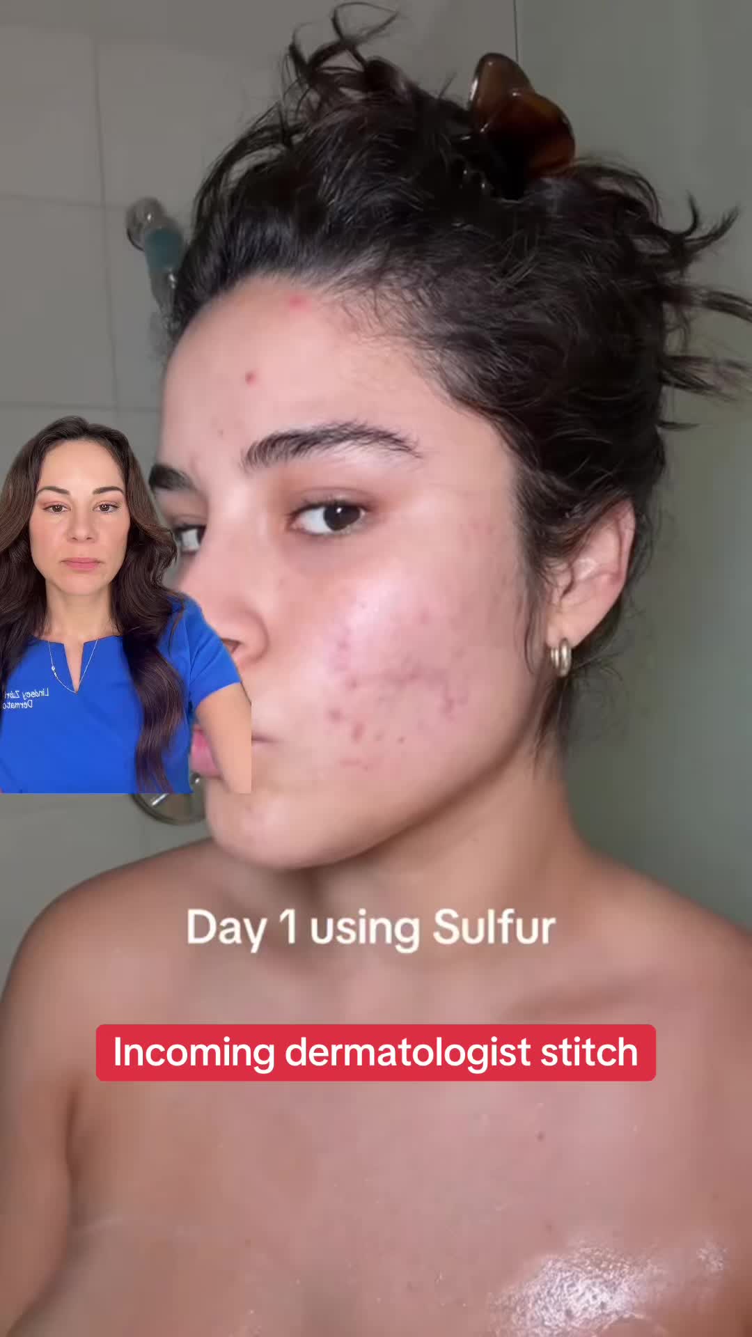 @Dermguru