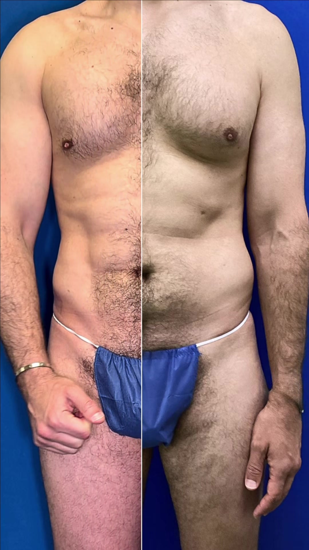@mensplasticsurgery