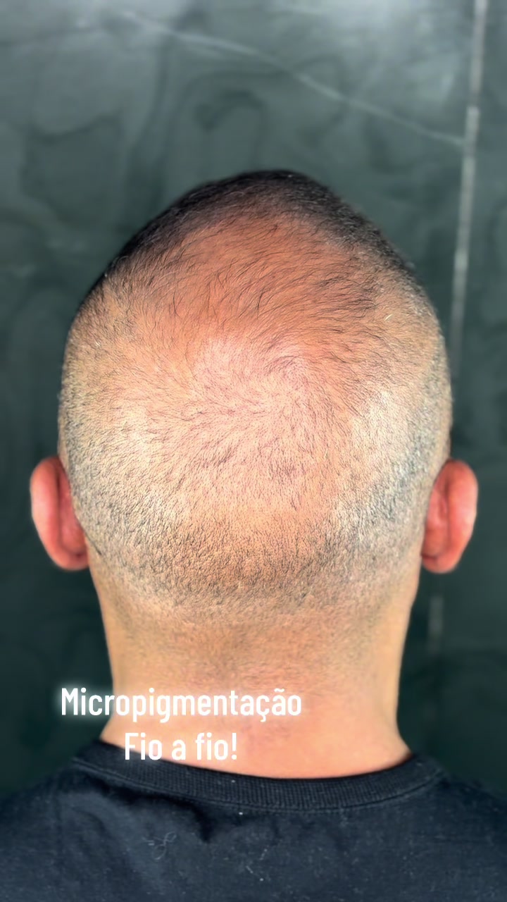 @Valesca Abi Ackel Scalp