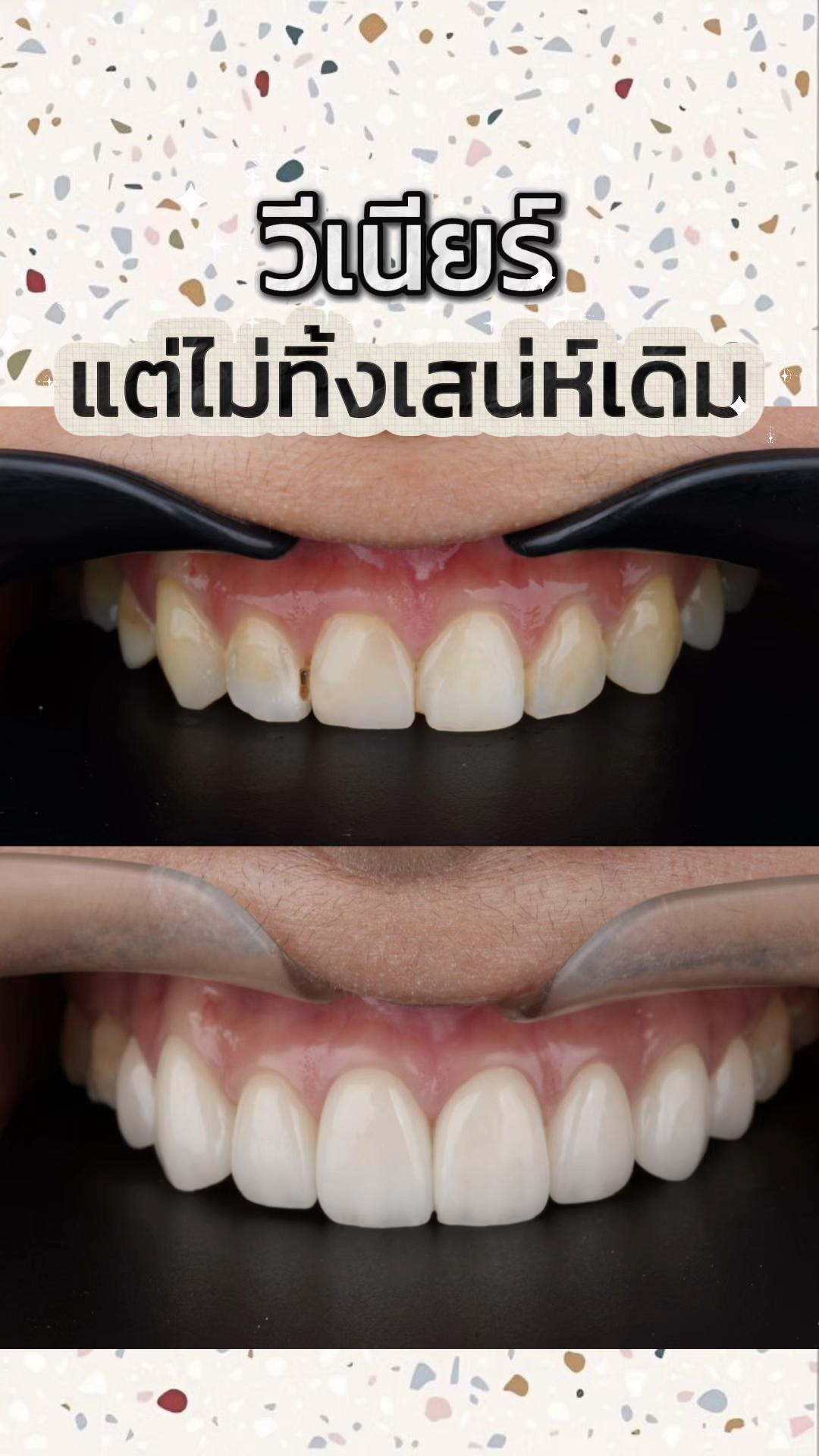 @smile Art Pattaya