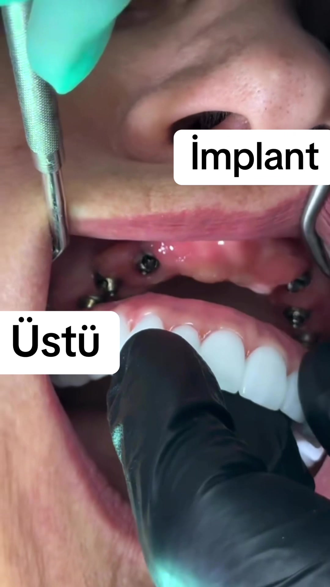 @Dentist_Günel