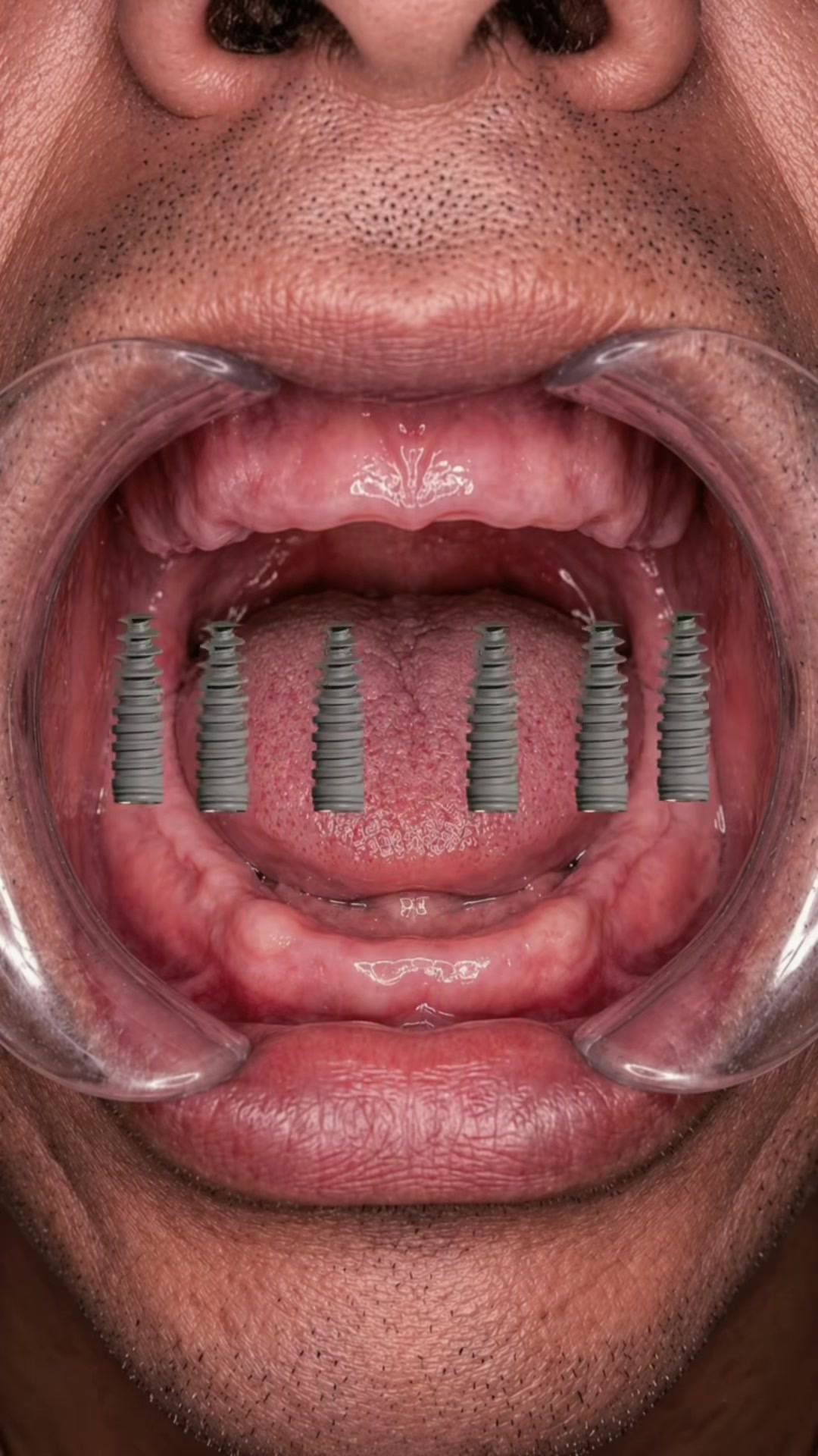 @Dent_tooth