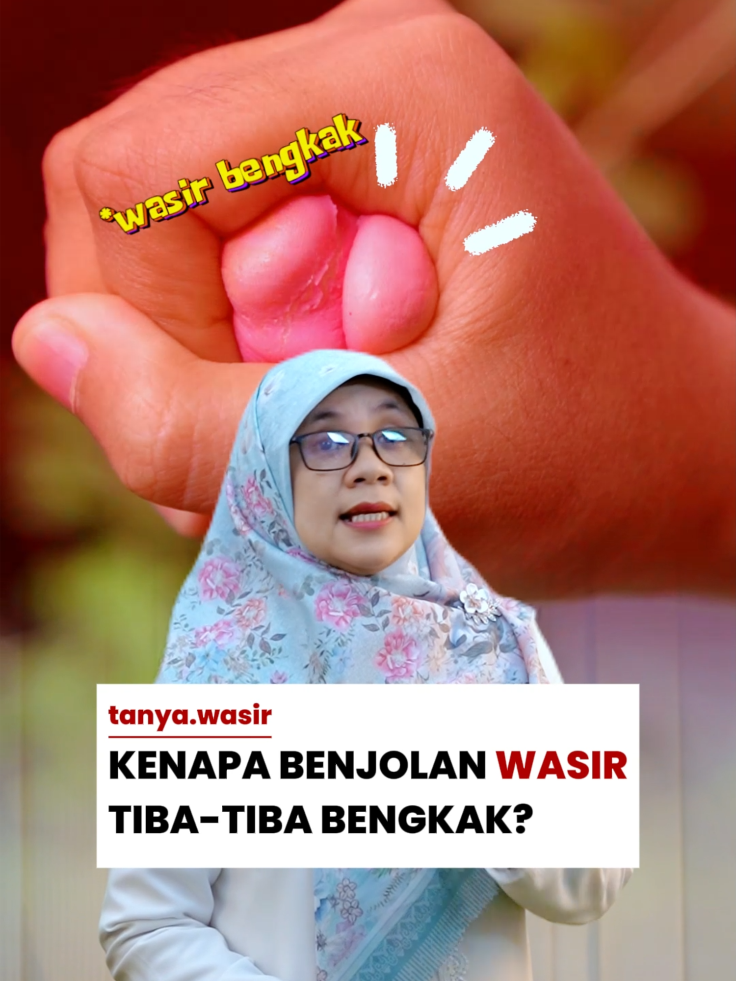 @tanyawasir | edukasi wasir