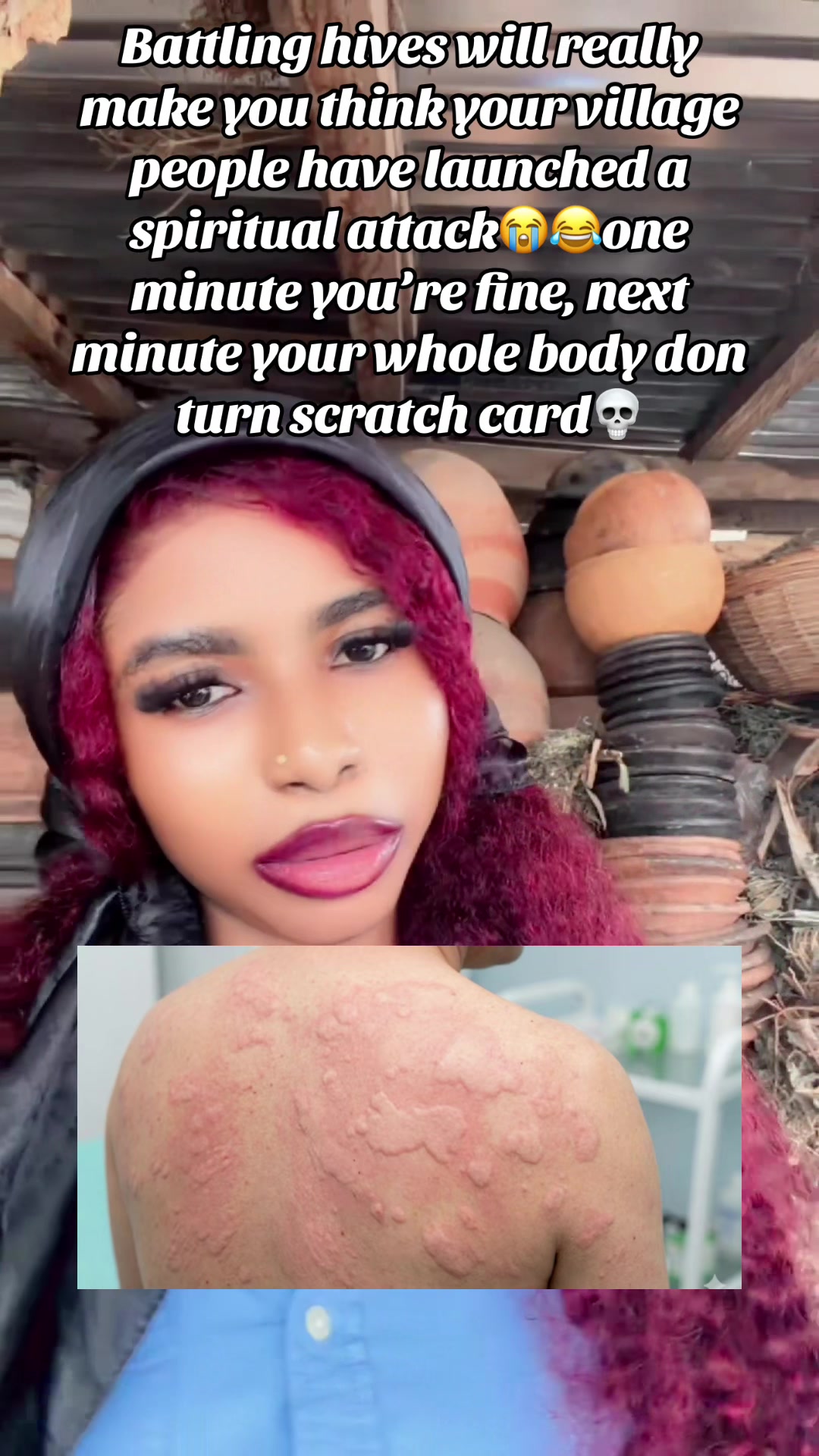 @GeNz_alagbo🐍🍯
