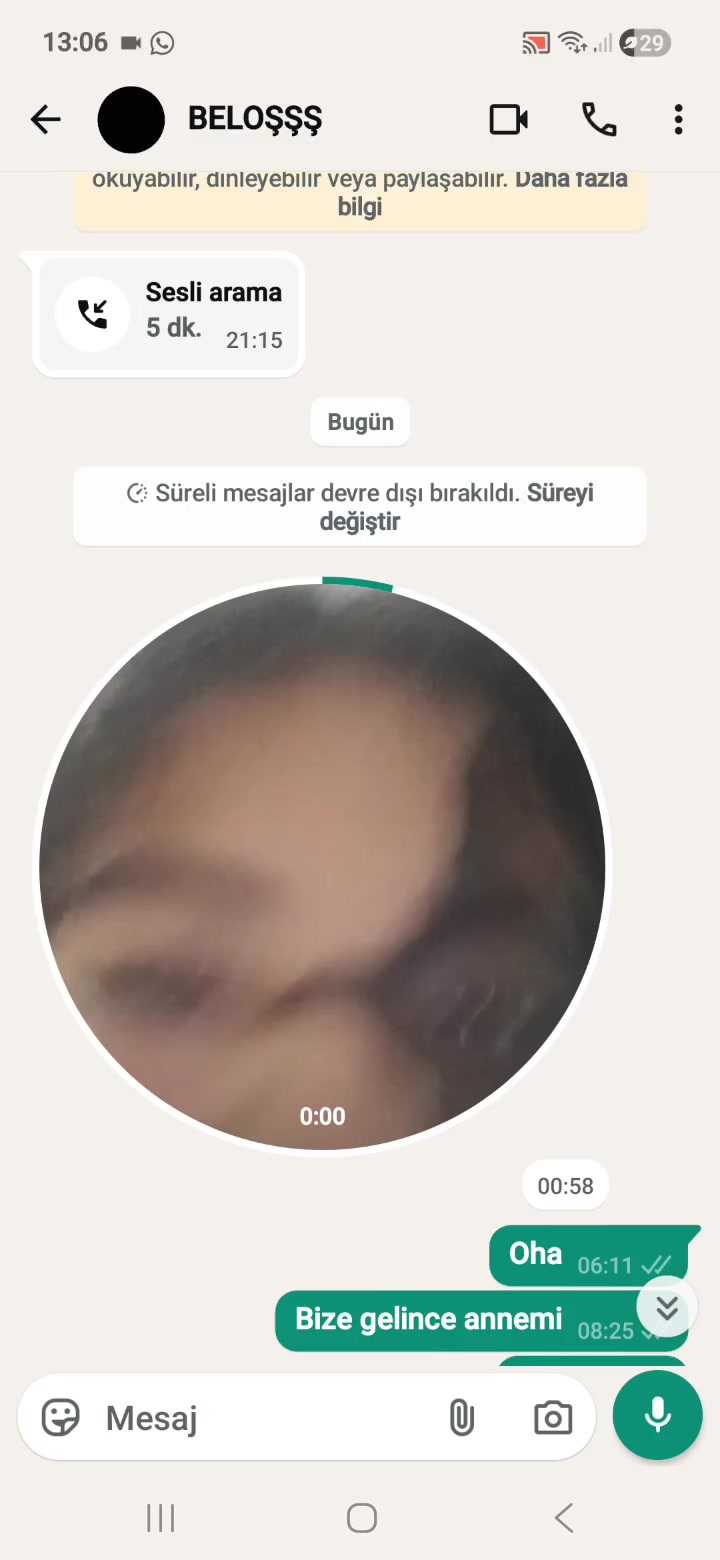 @BELİNAY FARK EDENE KADAR