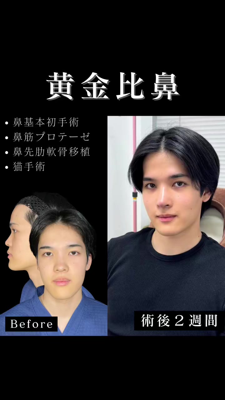 @ソ院長(バウム美容外科/トータル整形)