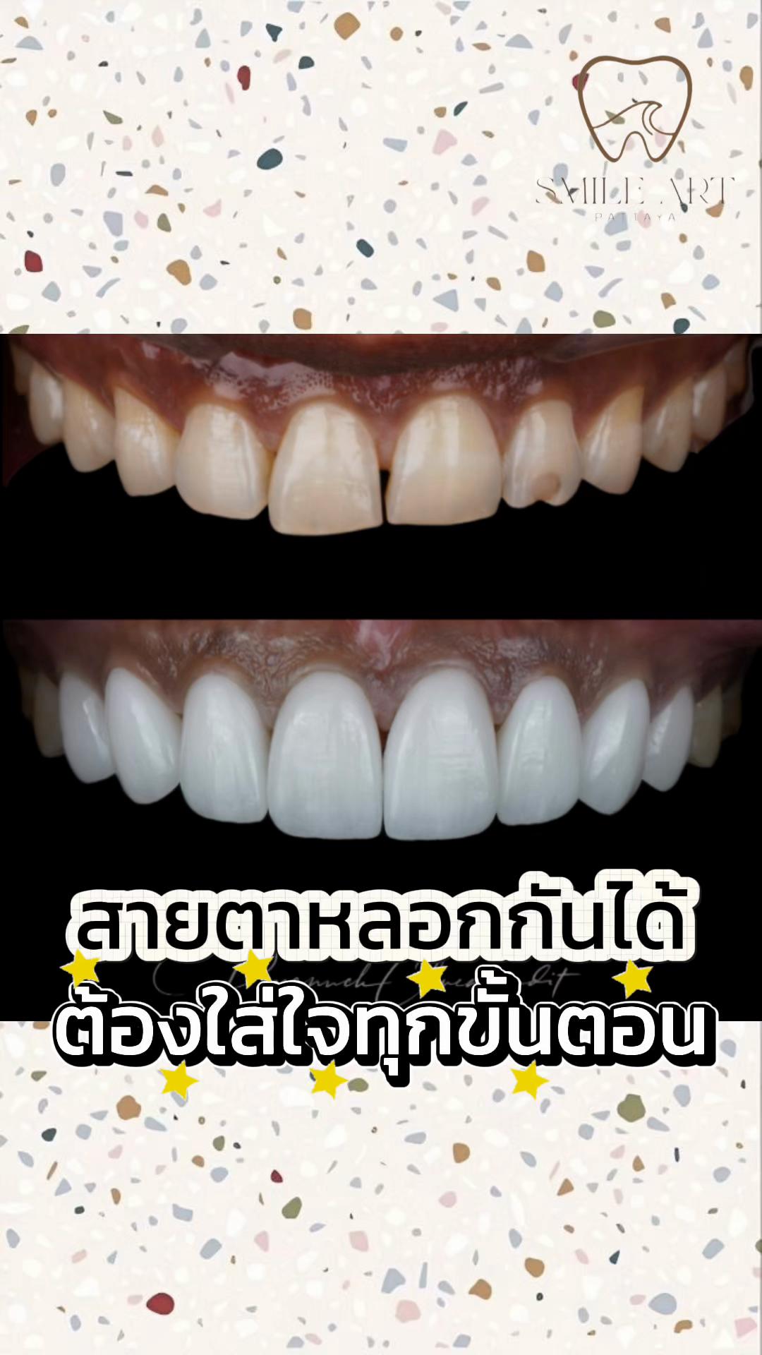 @smile Art Pattaya