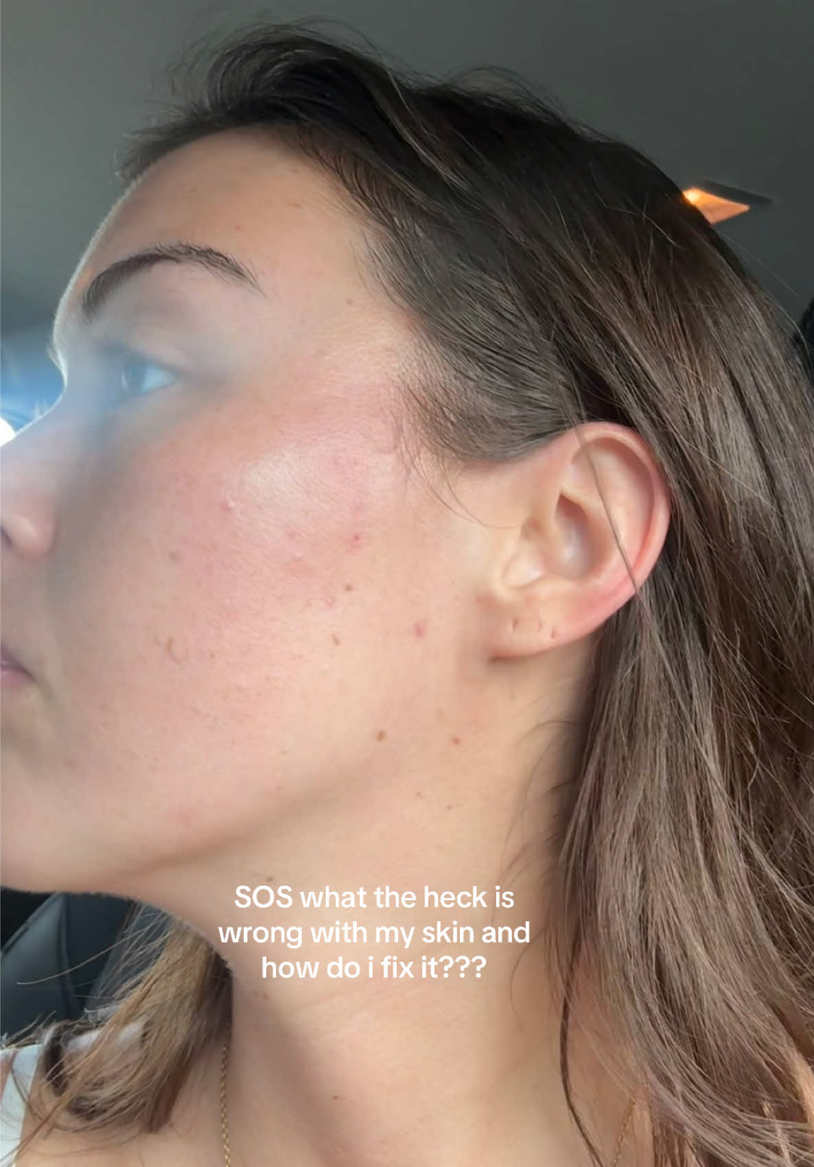 @Jaide Lehnert