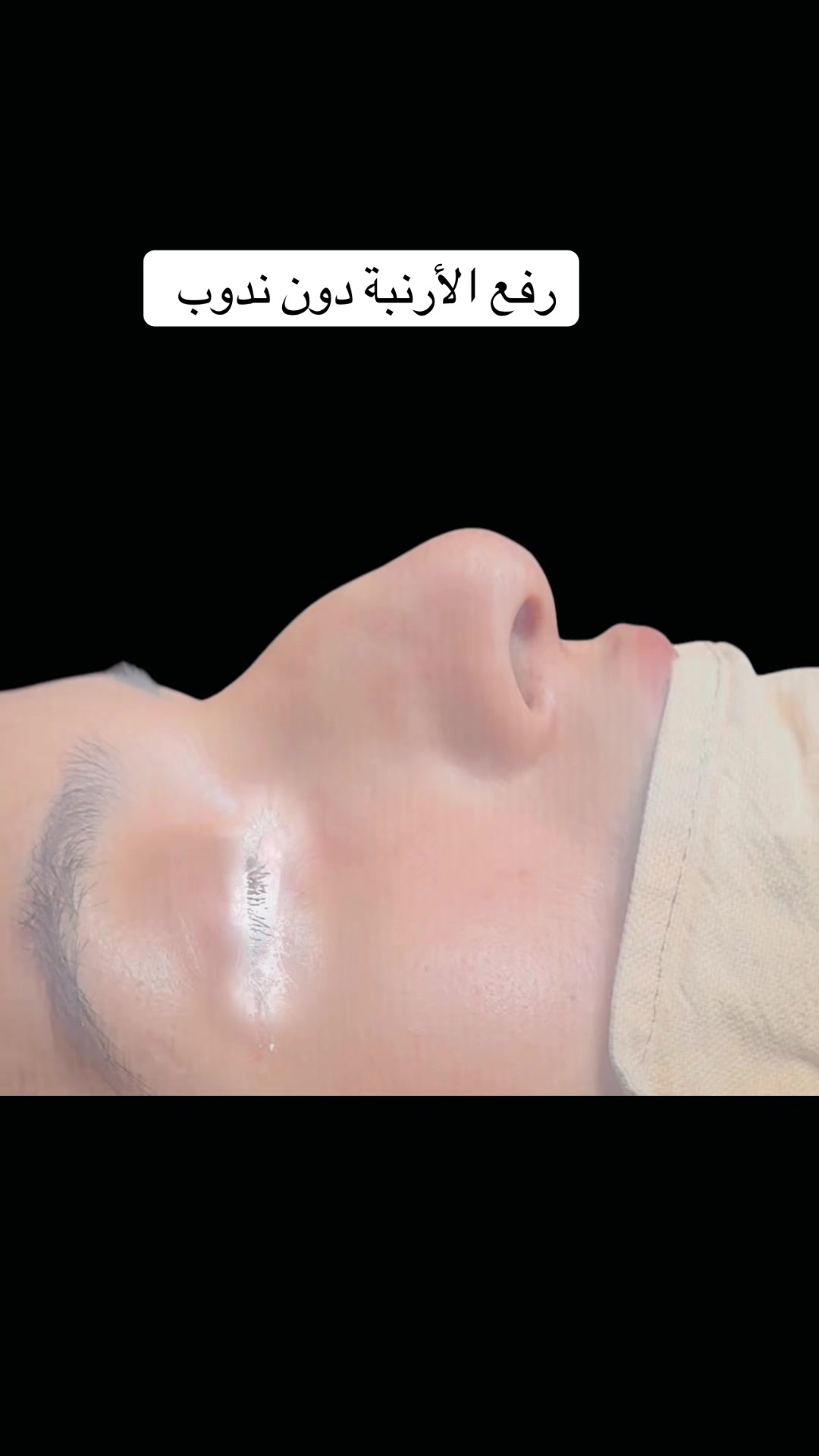 @Dr Larguet Abdelhak