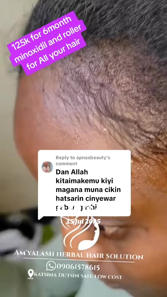 @Aunty solution skin and hair