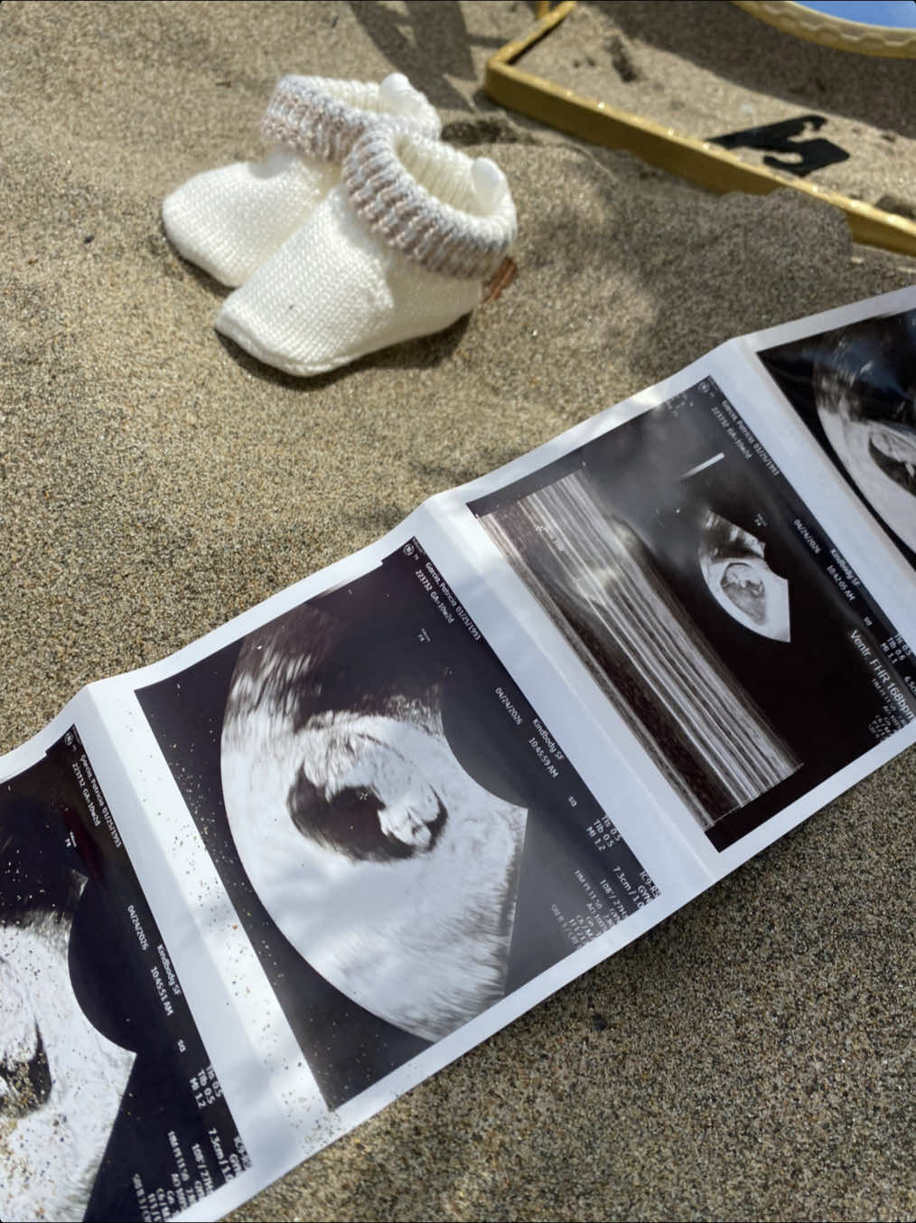 @Patricia | IVF Journey ๐ค๐