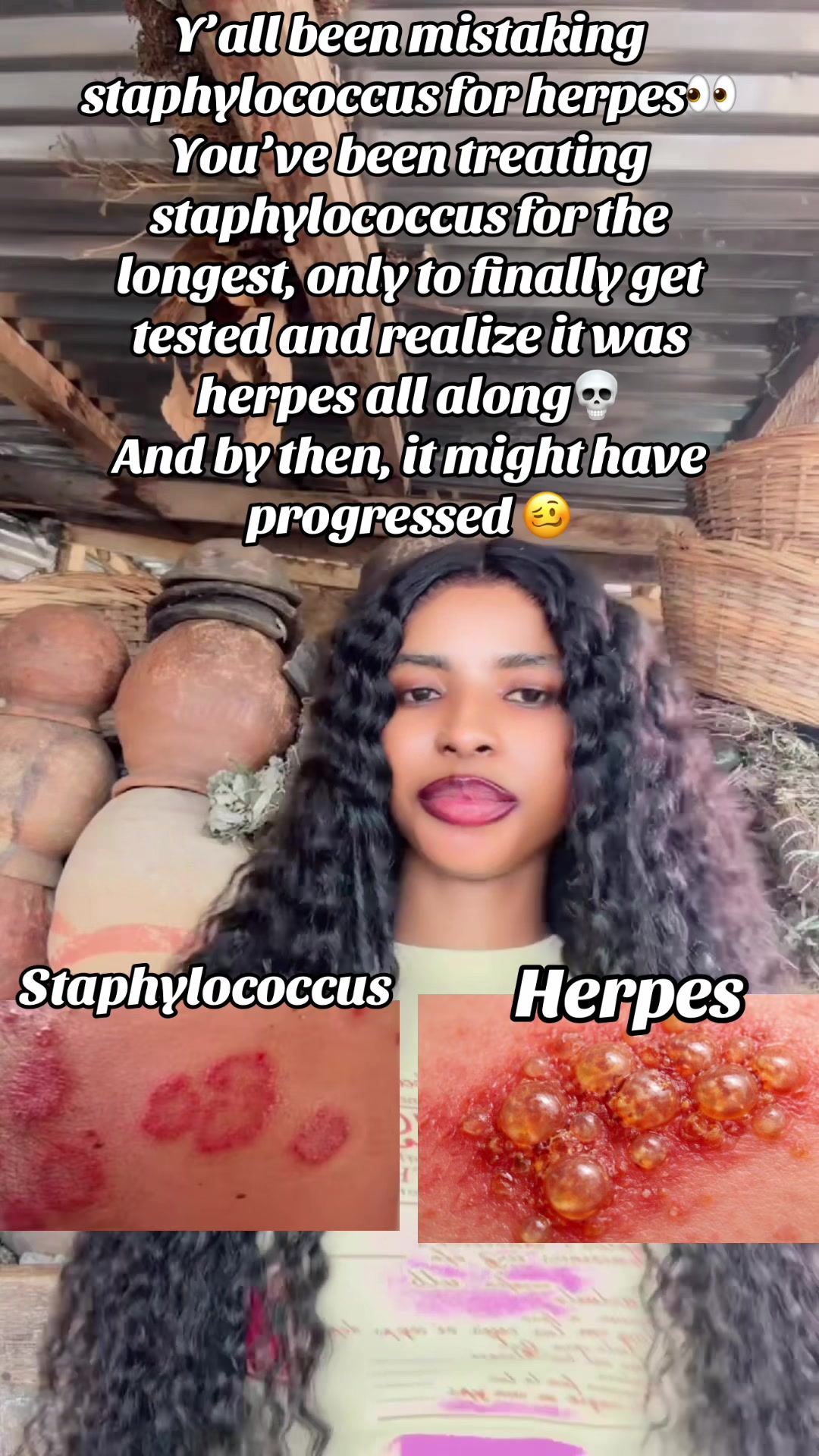 @GeNz_alagbo🐍🍯