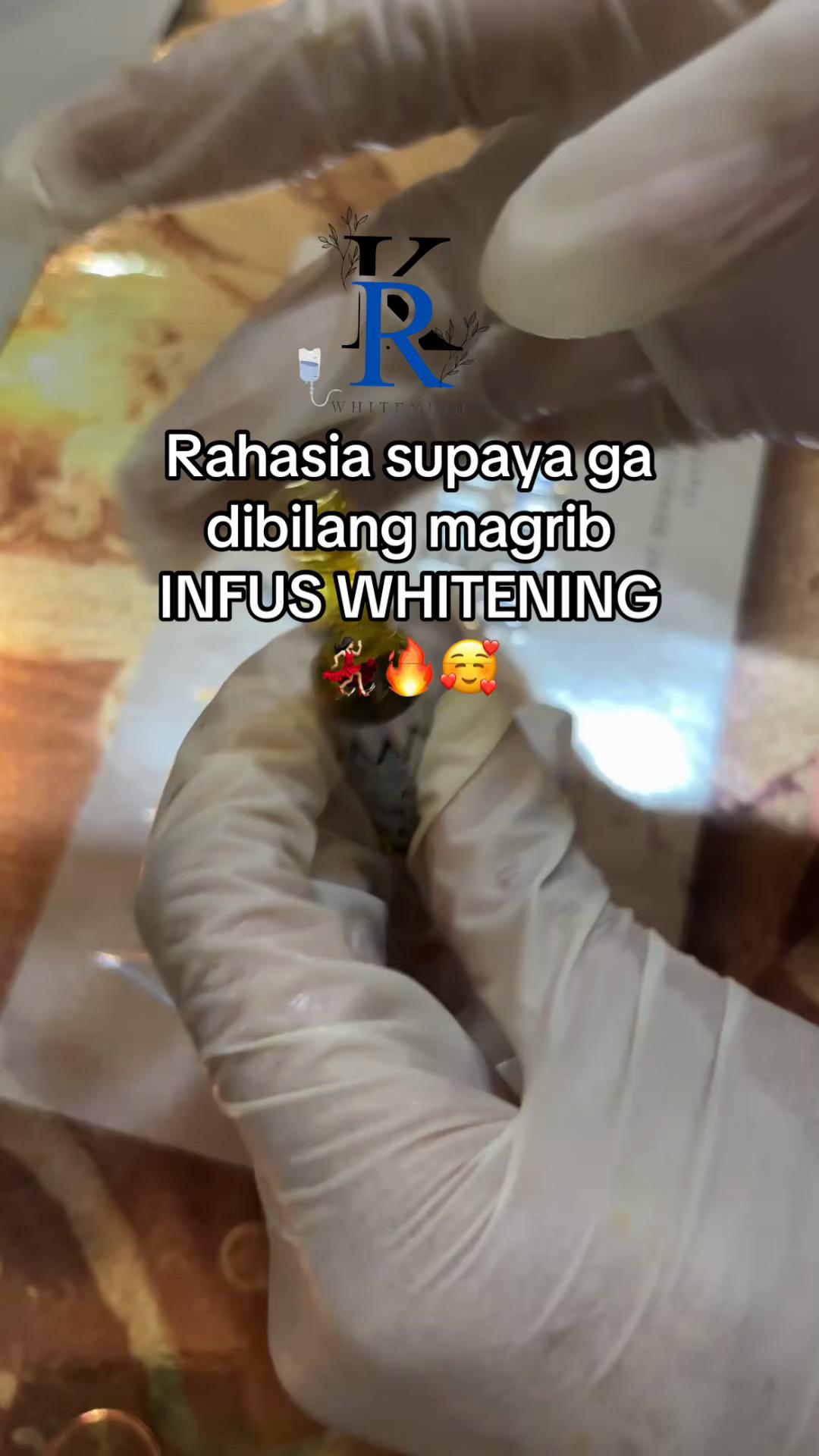 @RK WHITENING