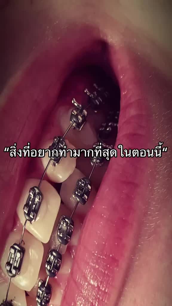 @Phasika