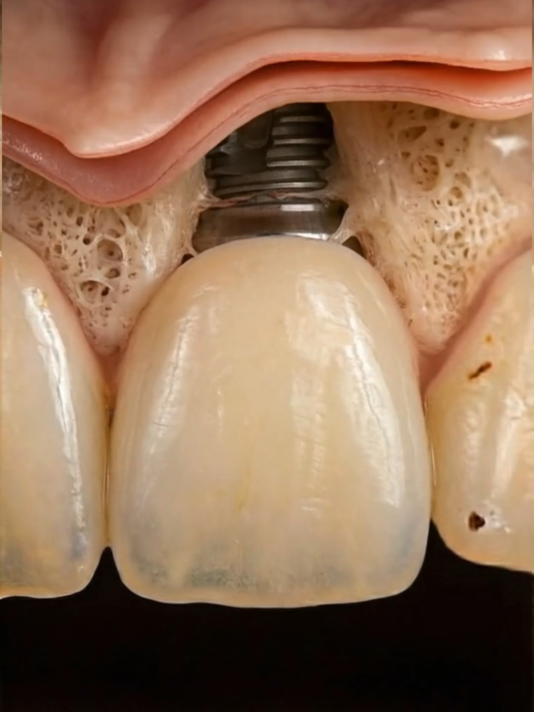 @Denti AI