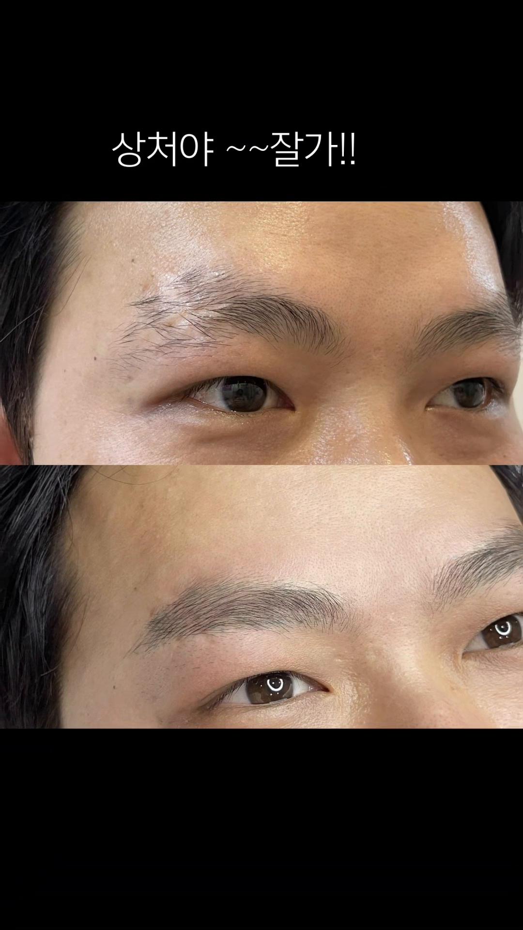 @운정피부관리 서연뷰티
