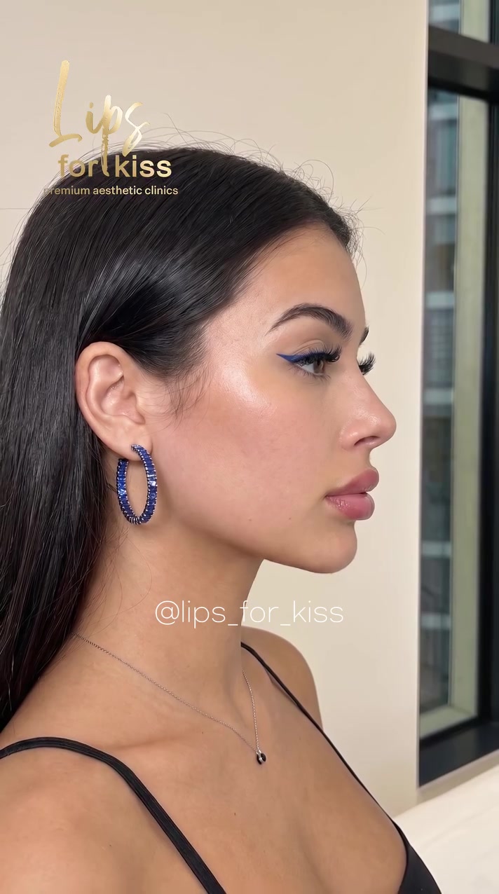 @Lips_for_kiss