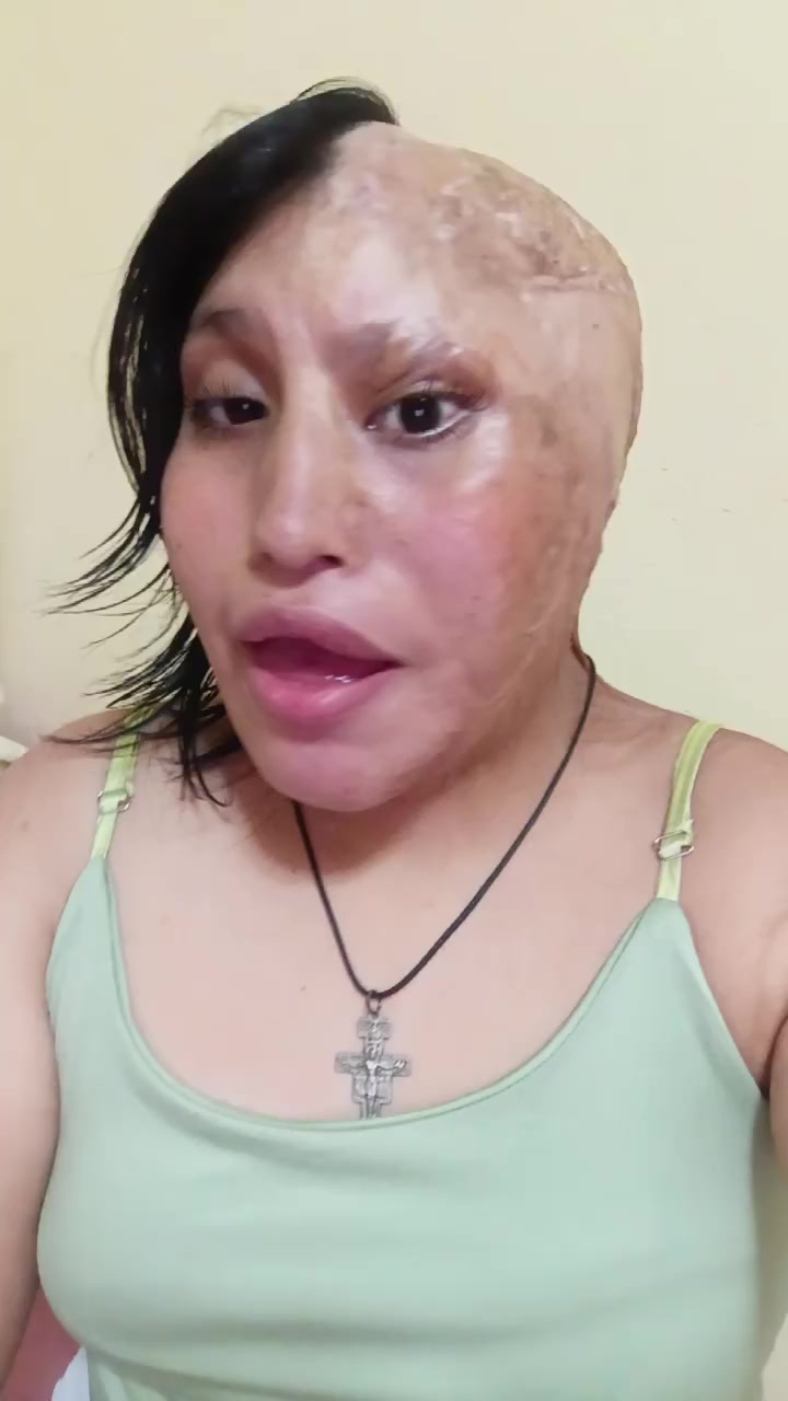 @Elizabeth Carri&oacute;n