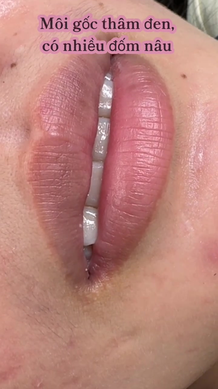 @Viện Thẩm Mỹ Hena