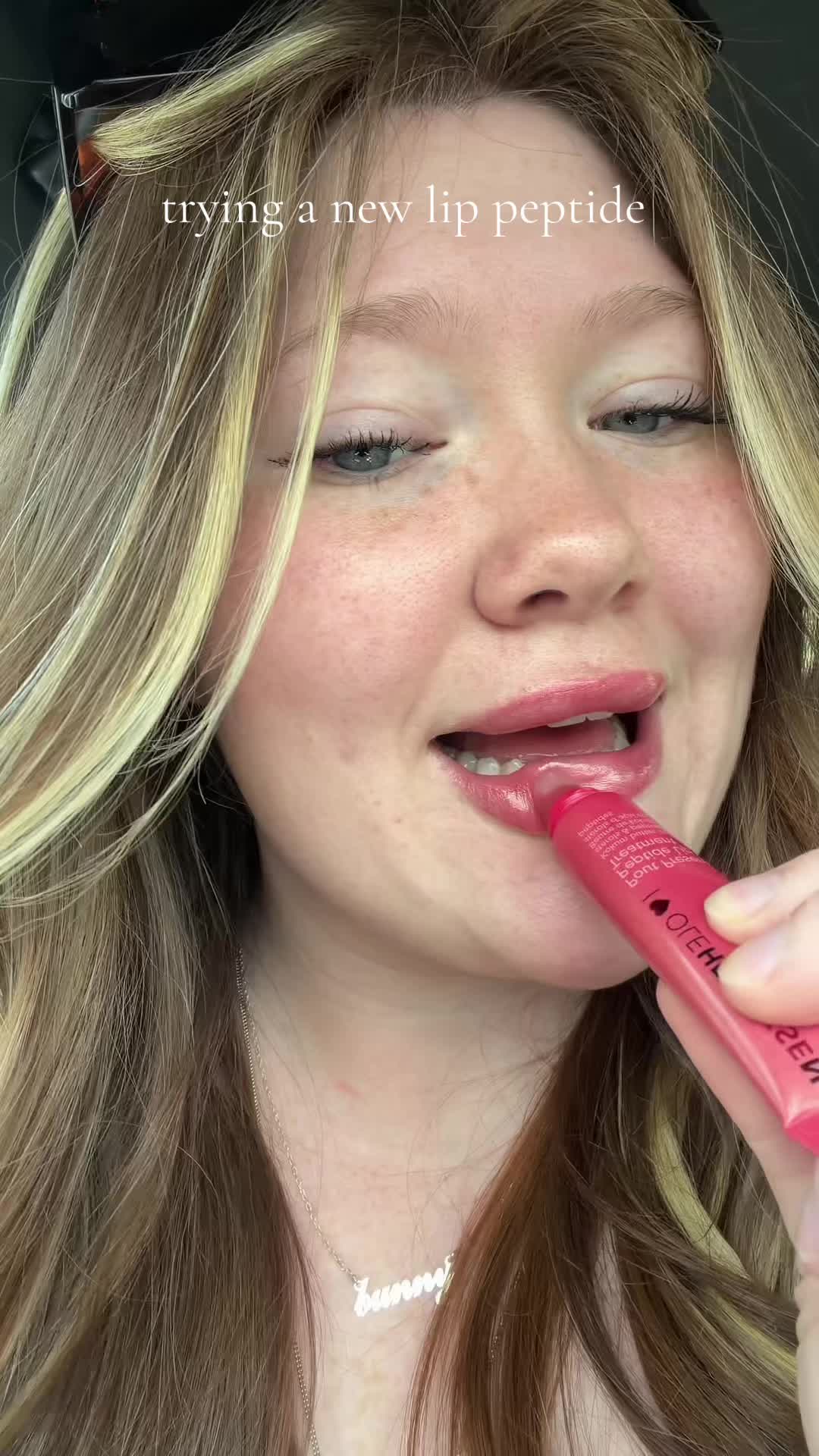 @Emma (: