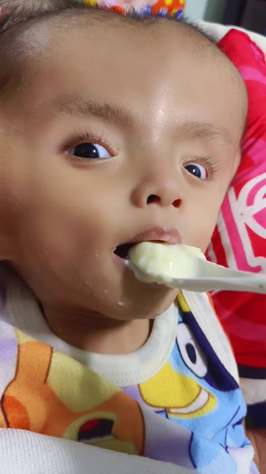 @บู้บี้เด็กหัวโตมีน้ำในโพรงสมอง
