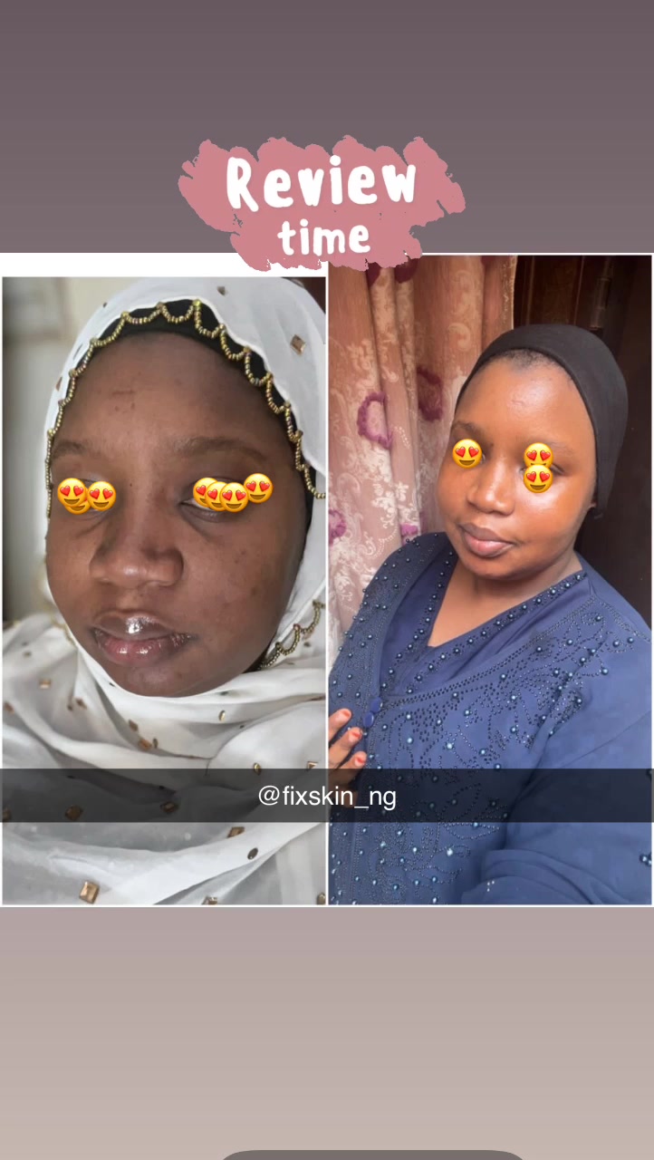 @FIX SKIN NIGERIA