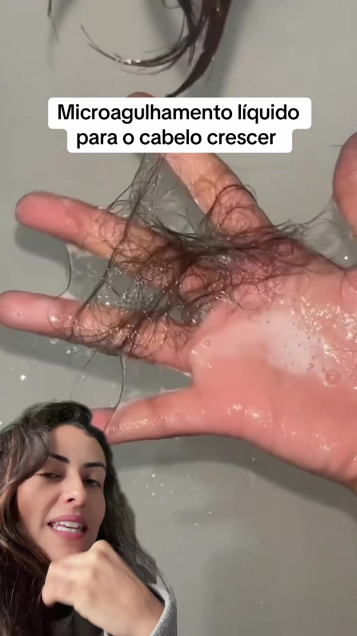 @achadosginger
