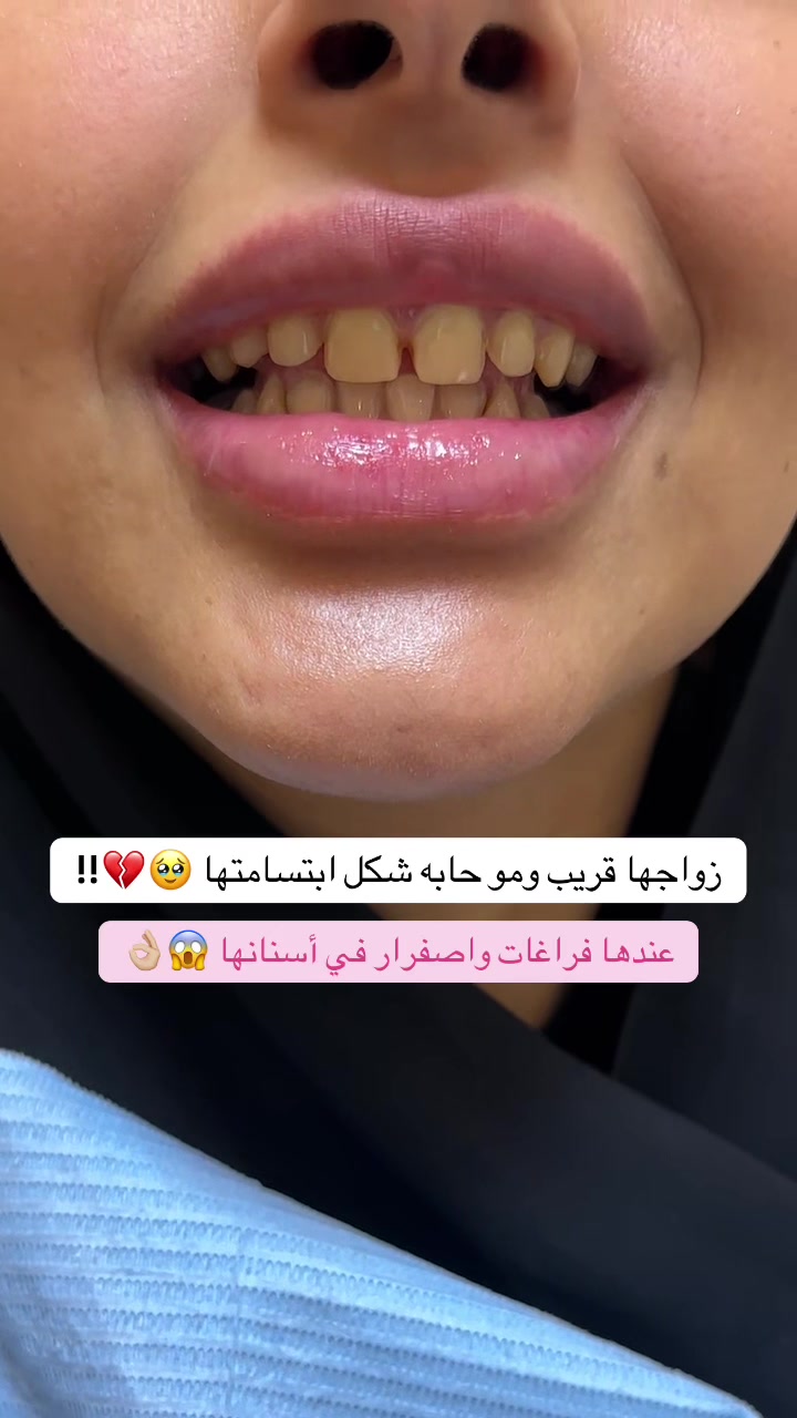 @عيادات البا للابتسامة
