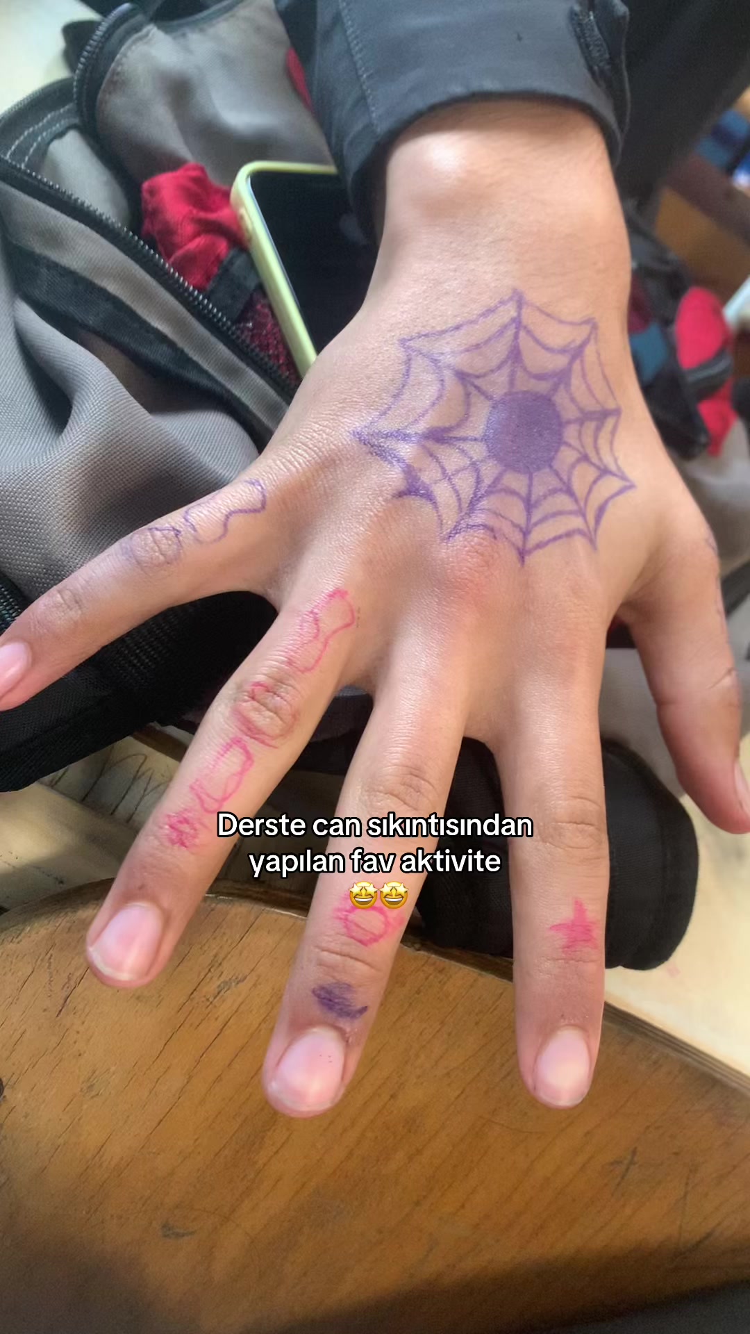 @11-B