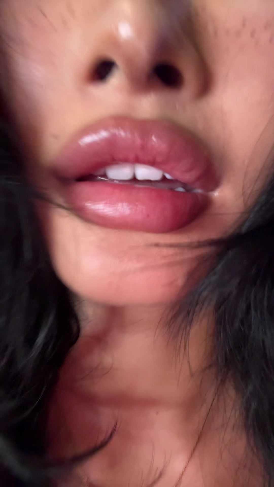 @Aimée with braces